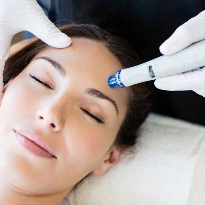 HydraFacial tretman lica